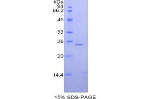 SDS-PAGE analysis of Mouse alpha Fodrin Protein. (SPTAN1 Protéine)