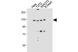 All lanes : Anti-Dnmt3a Antibody at 1:1000 dilution Lane 1: Hela whole cell lysate Lane 2: T47D whole cell lysate Lane 3: NIH/3T3 whole cell lysate Lane 4: Rat heart tissue lysate Lysates/proteins at 20 μg per lane. (DNMT3A anticorps  (AA 457-486))