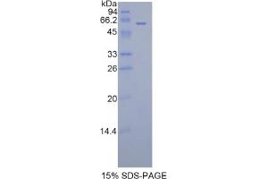 SDS-PAGE analysis of Rat FGL1 Protein. (FGL1 Protéine)