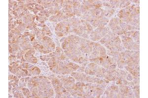 IHC-P Image Calcium binding protein P22 antibody [N2C2], Internal detects Calcium binding protein P22 protein at cytoplasm on SW480 xenograft by immunohistochemical analysis.