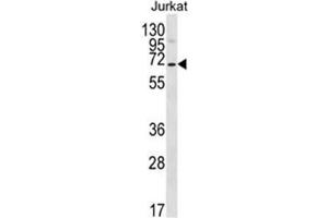 Western blot analysis of PSAPL1 Antibody (N-term) in Jurkat cell line lysates (35ug/lane). (PSAPL1 anticorps  (N-Term))