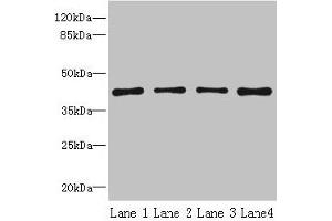 Western blot All lanes: S1PR1 antibody at 2 μg/mL Lane 1: Jurkat whole cell lysate Lane 2: A375 whole cell lysate Lane 3: Mouse thymus tissue Lane 4: HepG2 whole cell lysate Secondary Goat polyclonal to rabbit IgG at 1/10000 dilution Predicted band size: 43 kDa Observed band size: 43 kDa (S1PR1 anticorps  (AA 311-382))