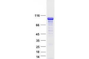 Validation with Western Blot