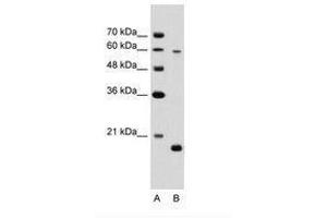 SLC38A4 anticorps  (AA 381-430)