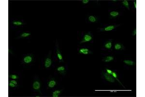 Immunofluorescence of purified MaxPab antibody to RFX2 on HeLa cell. (RFX2 anticorps  (AA 1-723))