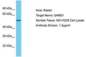 SAMD1 anticorps  (AA 434-483)