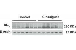 Western blot showing specific labeleing of BKCa/β-Actin in control and and Cinaciguat-treated lambs.