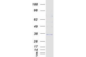 Validation with Western Blot