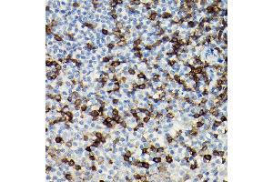 Immunohistochemistry of paraffin-embedded Human tonsil using CD3H antibody (ABIN3022812, ABIN3022813, ABIN3022814 and ABIN6219240) at dilution of 1:100 (40x lens). (CD247 anticorps  (AA 50-164))