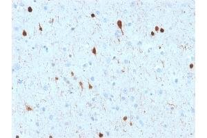 Formalin-fixed, paraffin-embedded human Cerebellum stained with Calretinin Mouse Monoclonal Antibody (CALB2/2602). (Calretinin anticorps  (AA 23-242))