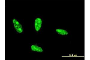 Immunofluorescence of monoclonal antibody to NHLH2 on HeLa cell. (NHLH2 anticorps  (AA 36-135))