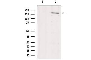 Western blot analysis of extracts from mouse brain, using Collagen XVII Antibody.