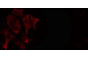 ABIN6266595 staining SKOV3 cells by IF/ICC. (MMP23B anticorps  (C-Term))