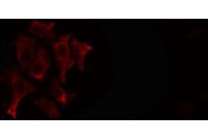 ABIN6266595 staining SKOV3 cells by IF/ICC.