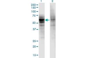 Western Blot analysis of DSTYK expression in transfected 293T cell line by DSTYK monoclonal antibody (M06), clone 1F9. (DSTYK anticorps  (AA 80-189))