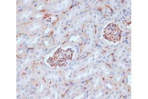 Immunohistochemistry of paraffin-embedded Mouse kidney using CD34 Polyclonal Antibody at dilution of 1:100 (40x lens). (CD34 anticorps)