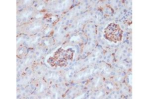 Immunohistochemistry of paraffin-embedded Mouse kidney using CD34 Polyclonal Antibody at dilution of 1:100 (40x lens). (CD34 anticorps)