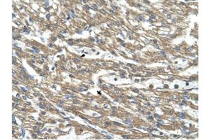 Cystathionase antibody was used for immunohistochemistry at a concentration of 4-8 ug/ml to stain Myocardial cells (arrows) in Human Head. (CTH anticorps)