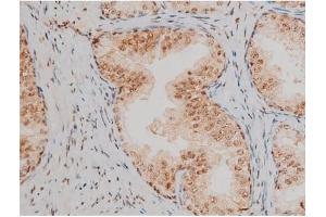ABIN6267411 at 1/200 staining Human prostate tissue sections by IHC-P.