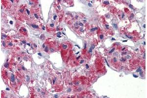 Human Adrenal (formalin-fixed, paraffin-embedded) stained with TAL1 antibody ABIN462261 followed by biotinylated goat anti-rabbit IgG secondary antibody ABIN481713, alkaline phosphatase-streptavidin and chromogen.