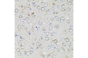 Immunohistochemistry of paraffin-embedded rat brain using BEST1 antibody (ABIN6003520) at dilution of 1/100 (40x lens). (Bestrophin 1 anticorps)