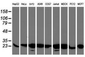 Image no. 7 for anti-Prefoldin Subunit 3 (PFDN3) antibody (ABIN1501706)