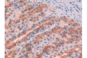 DAB staining on IHC-P; Samples: Rat Stomach Tissue (GAS6 anticorps  (AA 356-511))