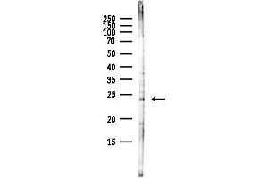 Western blot analysis of lysates from HepG2 cells(heat-shock,45 min treatment), using BS Antibody at 1/1000 dilution.