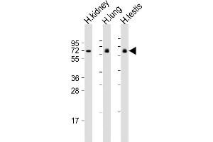 All lanes : Anti-LRRC1 Antibody (Center) at 1:2000 dilution Lane 1: human kidney lysate Lane 2: human lung lysate Lane 3: human testis lysate Lysates/proteins at 20 μg per lane. (LRRC1 anticorps  (AA 298-330))