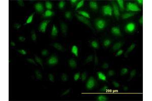 Immunofluorescence of monoclonal antibody to STIP1 on HeLa cell.