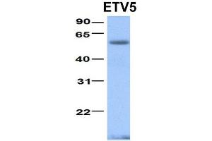 Host:  Rabbit  Target Name:  ETV5  Sample Type:  Human Fetal Heart  Antibody Dilution:  1. (ETV5 anticorps  (N-Term))