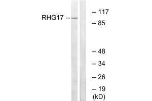 Western blot analysis of extracts from LOVO cells, using RHG17 antibody. (ARHGAP17 anticorps)