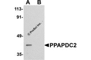 Western Blotting (WB) image for anti-Phosphatidic Acid Phosphatase Type 2 Domain Containing 2 (PPAPDC2) (C-Term) antibody (ABIN1030597) (PPAPDC2 anticorps  (C-Term))
