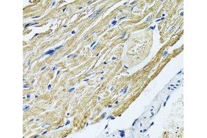 Immunohistochemistry of paraffin-embedded Mouse heart using SLC5A6 Polyclonal Antibody at dilution of 1:100 (40x lens).