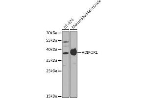 Western blot analysis of extracts of various cell lines, using  antibody (ABIN3022036, ABIN3022037, ABIN3022038 and ABIN6218580) at 1:1000 dilution. (Adiponectin Receptor 1 anticorps  (AA 1-136))