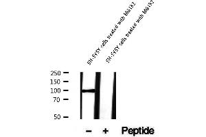 Western blot analysis of extracts of SH-SY5Y cells treated with MG132, using Phospho-FoxO3a (Ser413) Antibody .