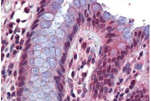 Human Colon: Formalin-Fixed, Paraffin-Embedded (FFPE)