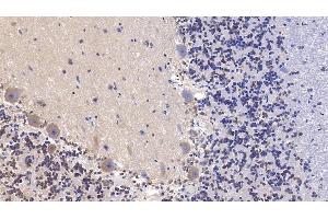 Detection of SHH in Human Cerebellum Tissue using Monoclonal Antibody to Hedgehog Homolog, Sonic (SHH)