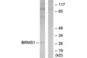 Western blot analysis of extracts from 293 cells, using BRMS1 Antibody. (BRMS1 anticorps  (AA 21-70))