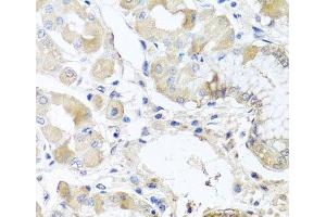 Immunohistochemistry of paraffin-embedded Human stomach using RPL36 Polyclonal Antibody at dilution of 1:100 (40x lens). (RPL36 anticorps)