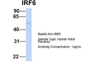 Host:  Rabbit  Target Name:  IRF6  Sample Type:  Human Adult Placenta  Antibody Dilution:  1. (IRF6 anticorps  (Middle Region))