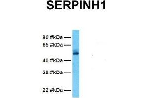 Host:  Rabbit  Target Name:  SERPINH1  Sample Tissue:  Human Fetal Lung  Antibody Dilution:  1.