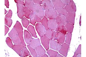 Anti-PYGM / Phosphorylase b antibody IHC of human skeletal muscle.