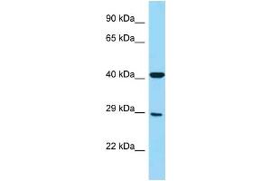 WB Suggested Anti-FCGR3A Antibody Titration: 1. (FCGR3A anticorps  (Middle Region))
