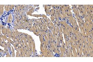Detection of MyD88 in Rat Cardiac Muscle Tissue using Polyclonal Antibody to Myeloid Differentiation Factor 88 (MyD88) (MYD88 anticorps  (AA 1-296))