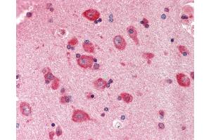 Anti-PYCR1 antibody IHC staining of human brain, cortex.