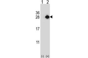 Western blot analysis of YEATS4 (arrow) using rabbit polyclonal YEATS4 Antibody . (GAS41 anticorps)