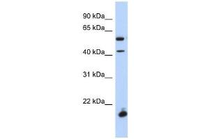 DBX1 antibody used at 0. (DBX1 anticorps  (Middle Region))