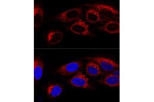 Confocal immunofluorescence analysis of U2OS cells using CK Polyclonal Antibody (ABIN6134474, ABIN6138645, ABIN6138646 and ABIN6223731) at dilution of 1:100. (CKAP4 anticorps)