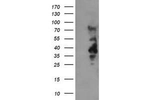 HEK293T cells were transfected with the pCMV6-ENTRY control (Left lane) or pCMV6-ENTRY LRRC25 (Right lane) cDNA for 48 hrs and lysed. (LRRC25 anticorps)